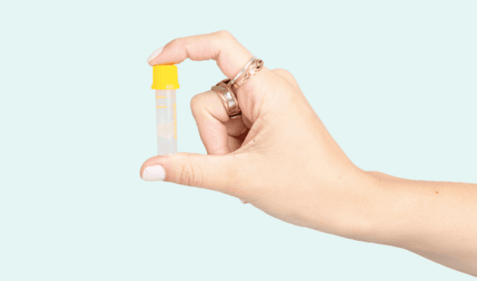 HSE offering free at-home STI test kits until Summer 2021